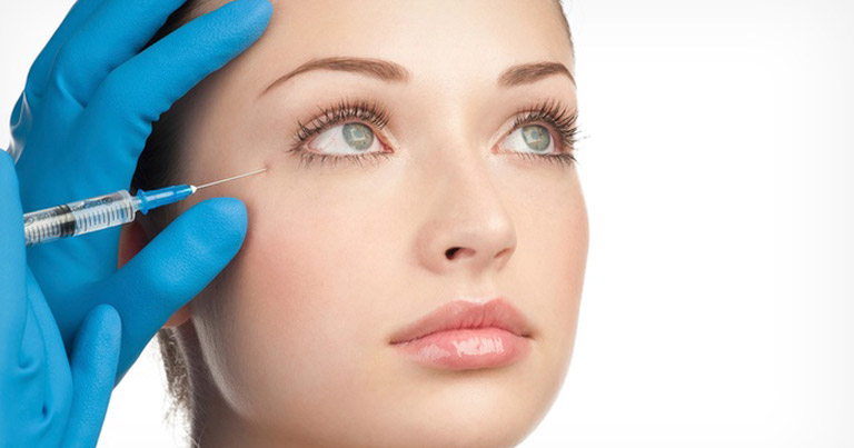 5 Mitos comunes sobre Botox